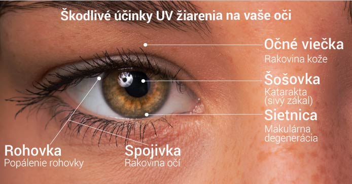 Škodlivé účinky UV lúčov na vaše oči